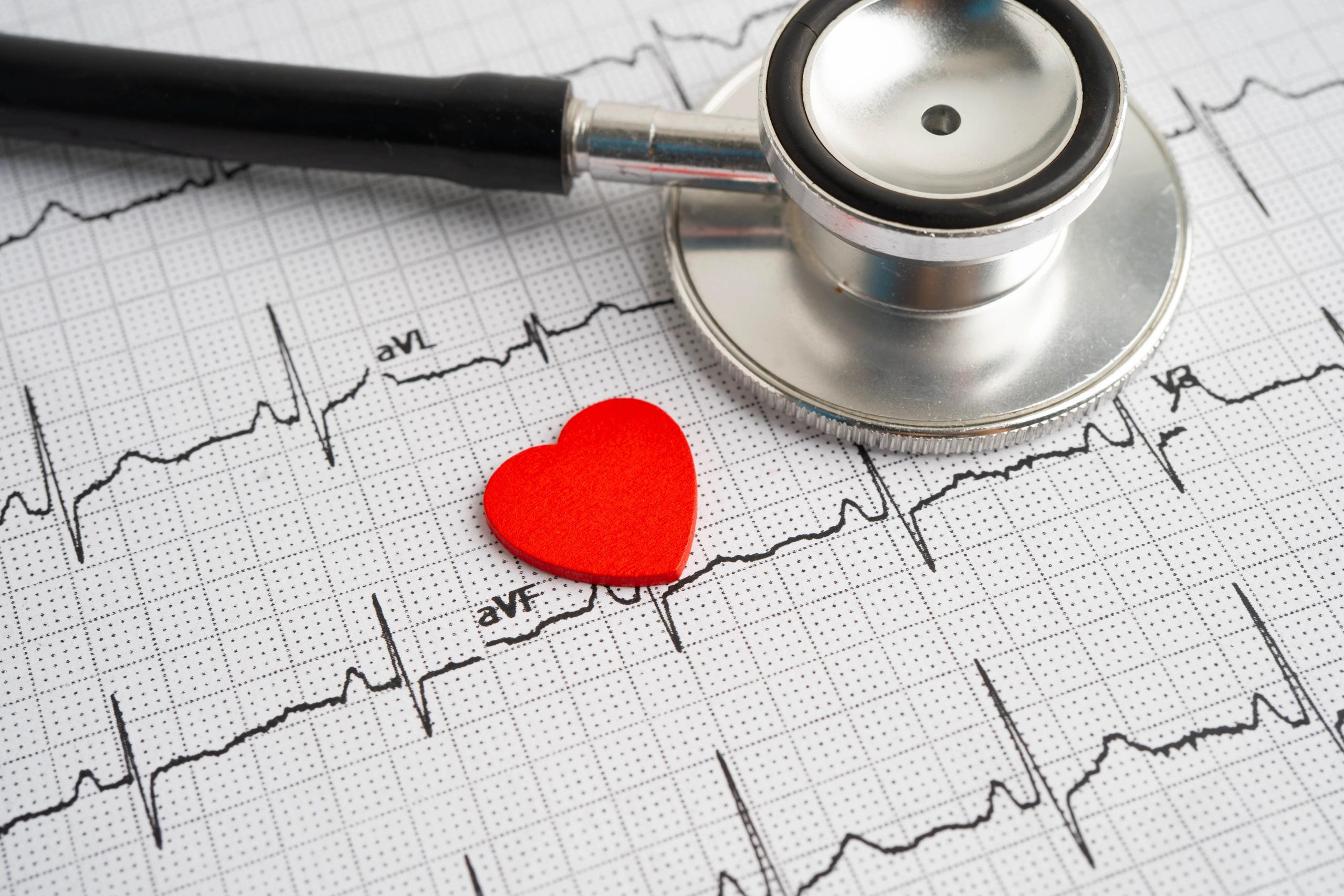 Electrocardiograma (ECG) con estetoscopio